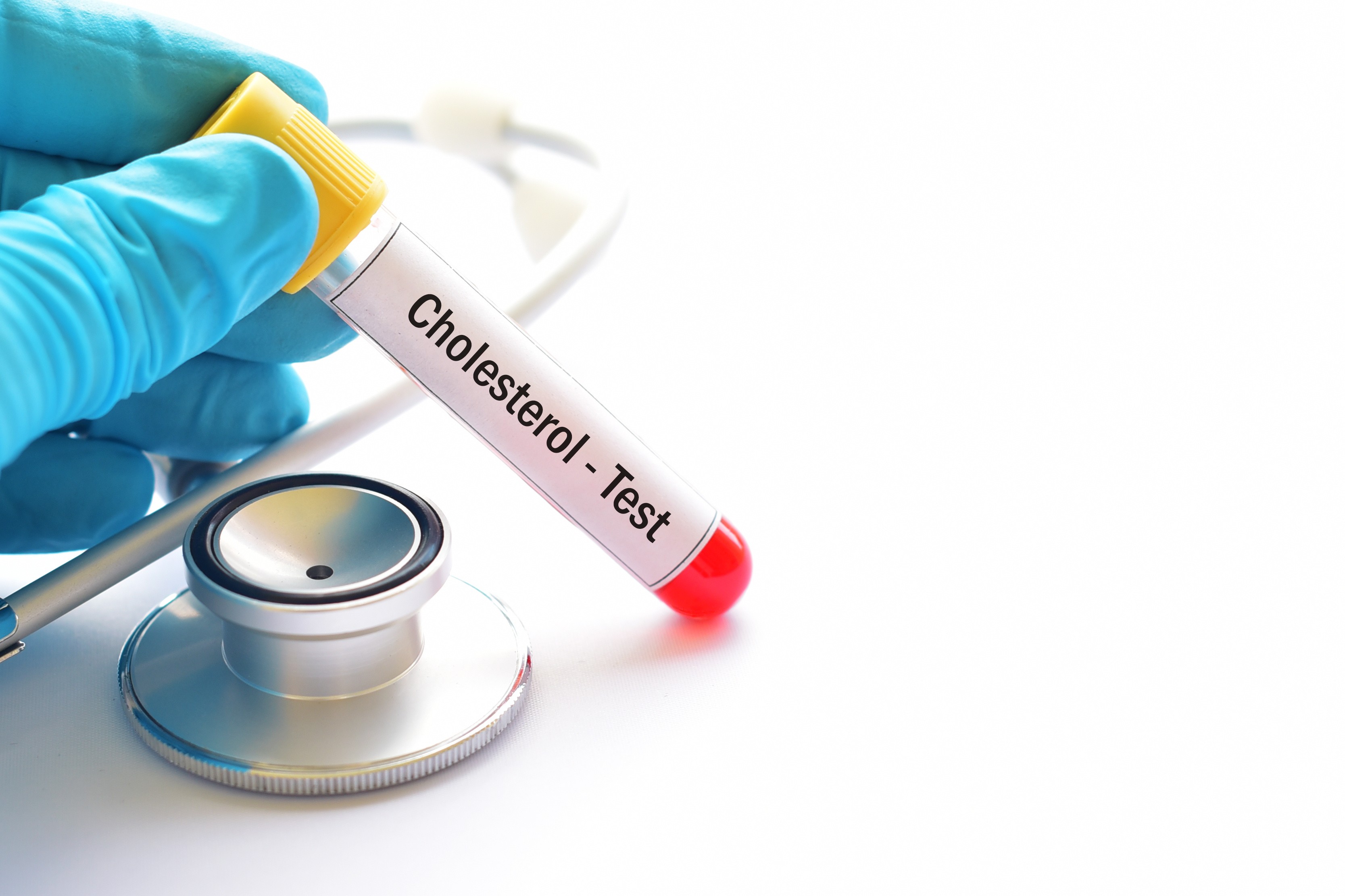 Jak prawidłowo odczytać wyniki badań cholesterolu? Poradnik